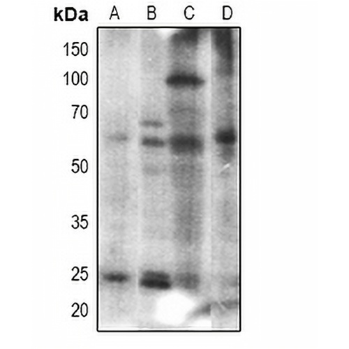 Histone Deacetylase 2 Rabbit Polyclonal Antibody