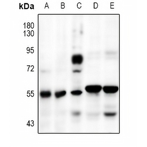 SMAD2 Rabbit Polyclonal Antibody