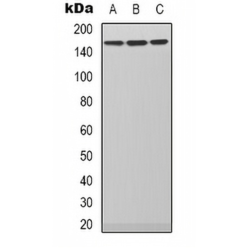 PLC beta 3 Rabbit Polyclonal Antibody