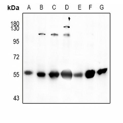 SGK1 Rabbit Polyclonal Antibody