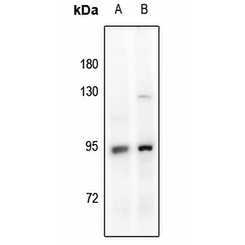 Glucocorticoid Receptor Rabbit Polyclonal Antibody