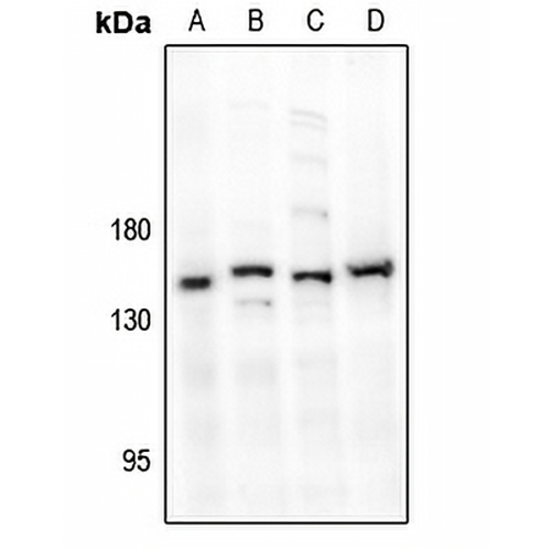 MYPT1 Rabbit Polyclonal Antibody