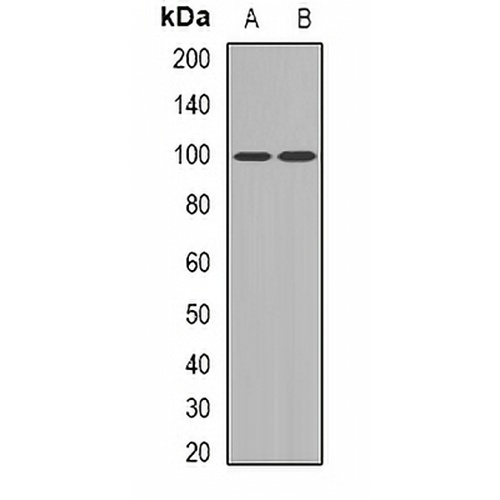 UBF Rabbit Polyclonal Antibody