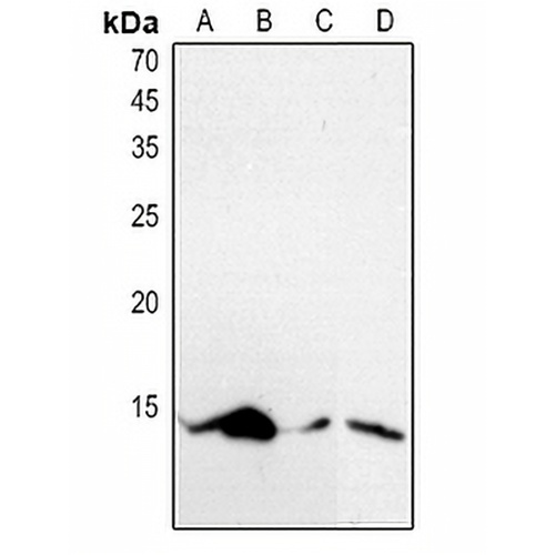 Histone H4 (Acetyl-K5) Rabbit Polyclonal Antibody