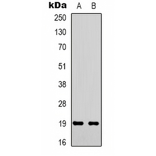 STMN1 (Phospho-S38) Rabbit Polyclonal Antibody