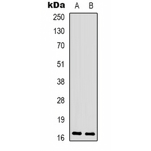 CPI17 (Phospho-T38) Rabbit Polyclonal Antibody