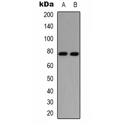 PKC delta (Phospho-S645) Rabbit Polyclonal Antibody