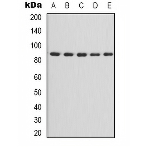 IKK alpha/beta Rabbit Polyclonal Antibody