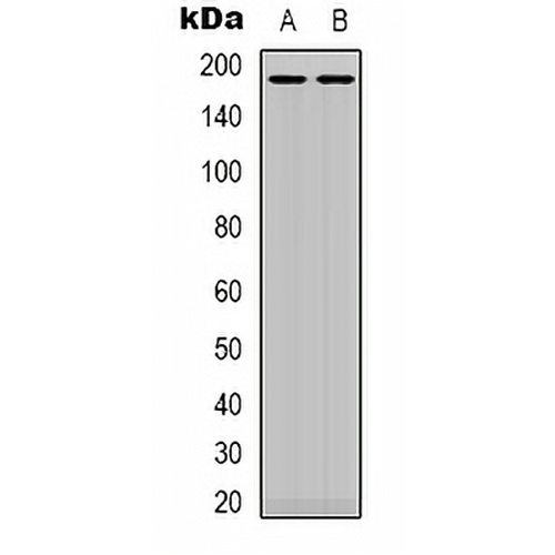 IRS1 Rabbit Polyclonal Antibody