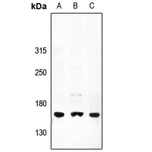 ATP7A Rabbit Polyclonal Antibody