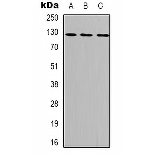 Focal Adhesion Kinase (Phospho-Y407) Rabbit Polyclonal Antibody