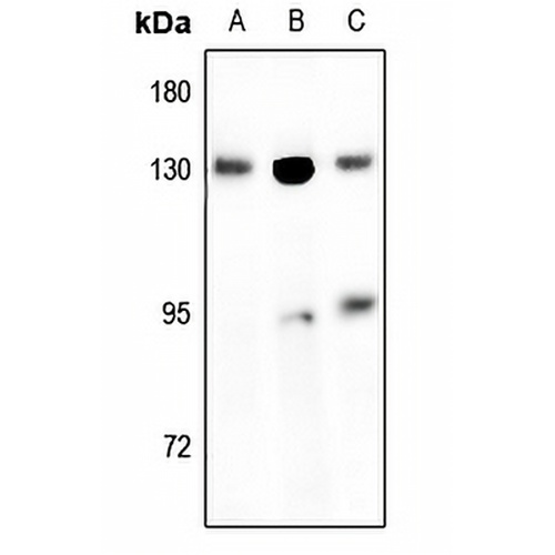 EPHB1/2 Rabbit Polyclonal Antibody
