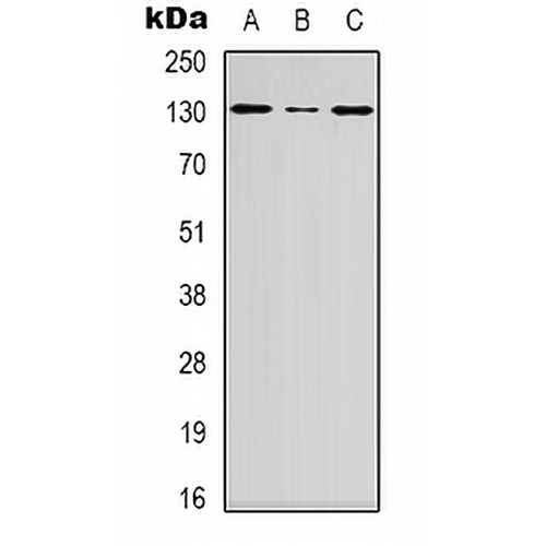 DGK iota Rabbit Polyclonal Antibody