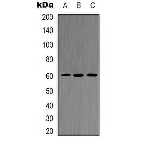 AKT2 (Phospho-S474) Rabbit Polyclonal Antibody