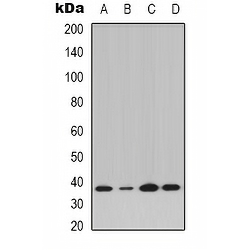 IKB alpha (Phospho-Y42) Rabbit Polyclonal Antibody