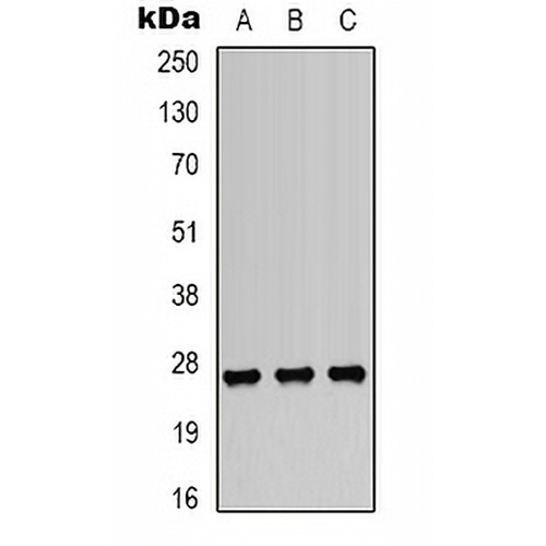 HSP27 (Phospho-S82) Rabbit Polyclonal Antibody