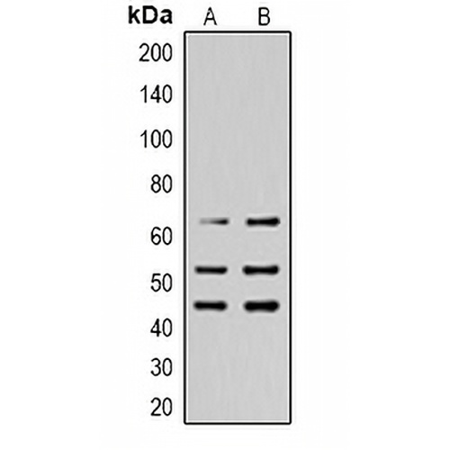 SHCA (Phospho-Y427) Rabbit Polyclonal Antibody