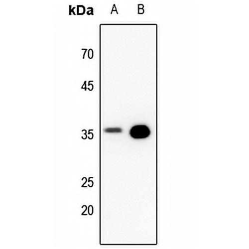 PPP2CA Rabbit Polyclonal Antibody
