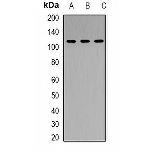 RB1 Rabbit Polyclonal Antibody