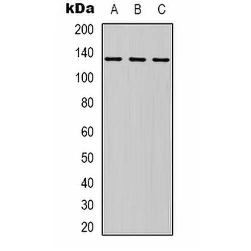 HER2 Rabbit Polyclonal Antibody