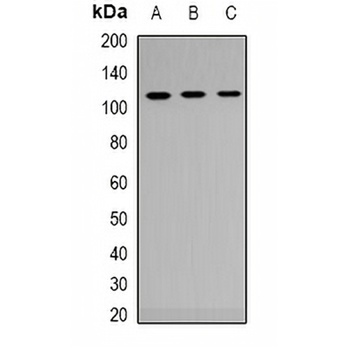 Androgen Receptor Rabbit Polyclonal Antibody