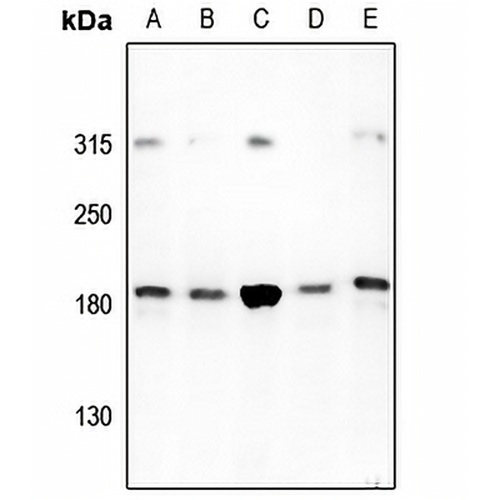 HER2 Rabbit Polyclonal Antibody