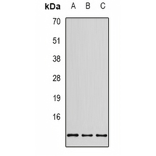 RPS20 Rabbit Polyclonal Antibody