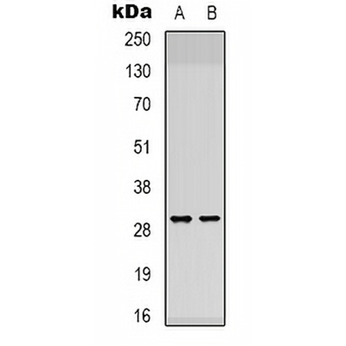 ATP5F1 Rabbit Polyclonal Antibody