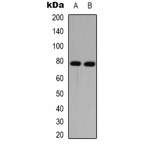 DNAI1 Rabbit Polyclonal Antibody