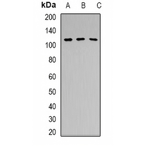 PRPF6 Rabbit Polyclonal Antibody