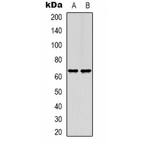 TIGD1 Rabbit Polyclonal Antibody