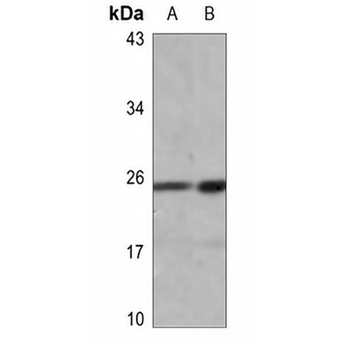 HMGB1 (Acetyl-K12) Rabbit Polyclonal Antibody