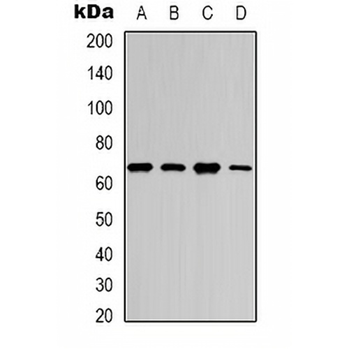 NF-kappaB p65 (Acetyl-K218) Rabbit Polyclonal Antibody