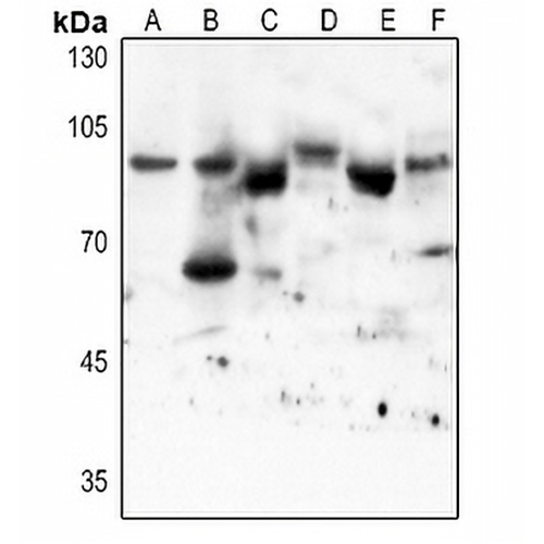 STAT3 (Acetyl-K87) Rabbit Polyclonal Antibody
