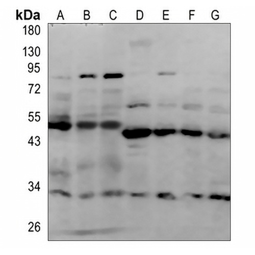 HDJ2 Rabbit Polyclonal Antibody