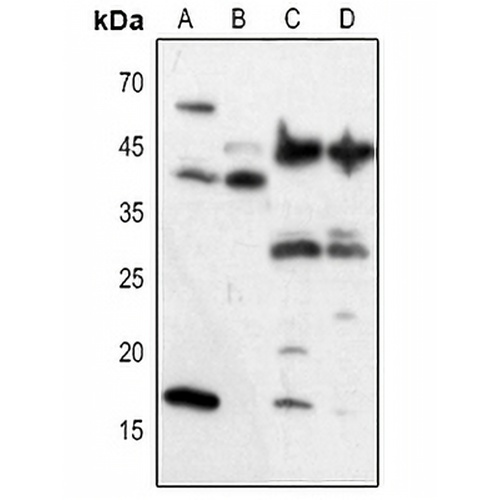 VEGFA Rabbit Polyclonal Antibody
