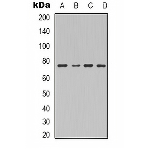Factor XIII B Rabbit Polyclonal Antibody