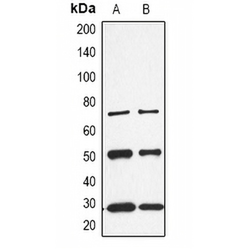 CALB1 Rabbit Polyclonal Antibody