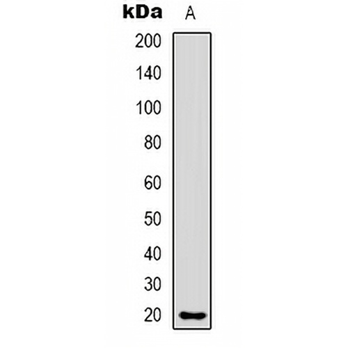 CMTM8 Rabbit Polyclonal Antibody