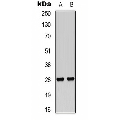 VEGI Rabbit Polyclonal Antibody