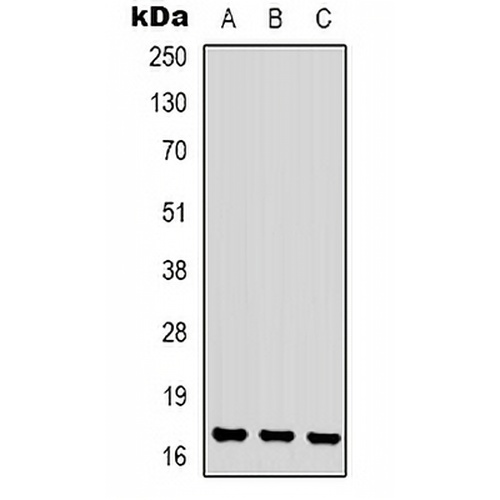 CKLF1 Rabbit Polyclonal Antibody