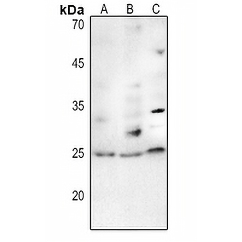TP53INP2 Rabbit Polyclonal Antibody