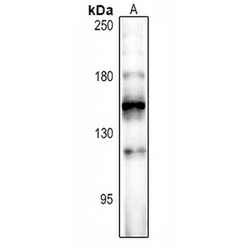 FOG2 Rabbit Polyclonal Antibody