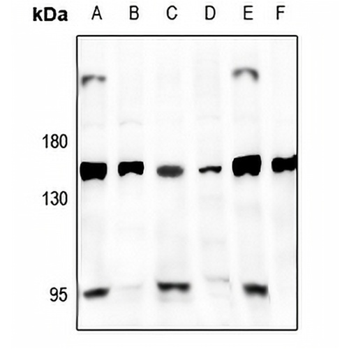 GPR126 Rabbit Polyclonal Antibody