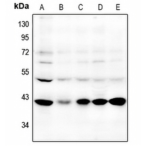 GPR87 Rabbit Polyclonal Antibody