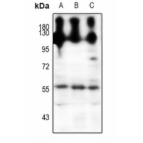 NPY5R Rabbit Polyclonal Antibody