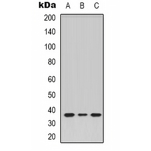 TRB1 Rabbit Polyclonal Antibody