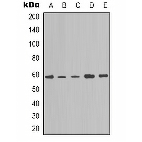 NOTCH4 Rabbit Polyclonal Antibody