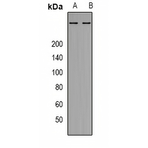 ATM Rabbit Polyclonal Antibody