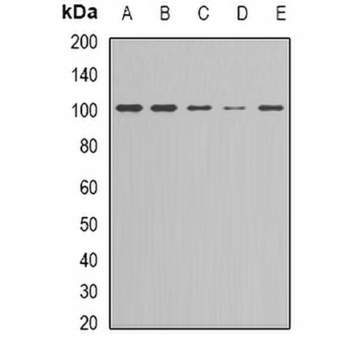 NF-kappaB p100 Rabbit Polyclonal Antibody